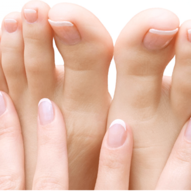 What is the Best Nail Fungus Treatment of 2018?