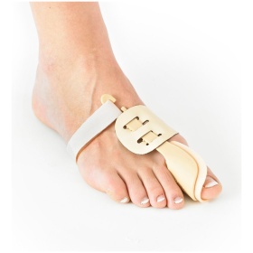 NEOG511 – Bunion Correction system 4
