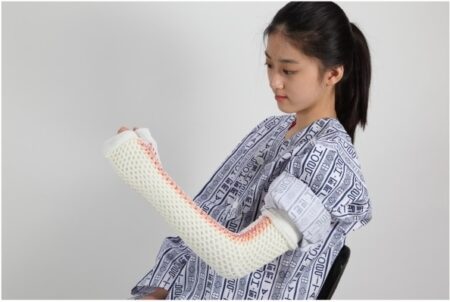 Splinting and Casting