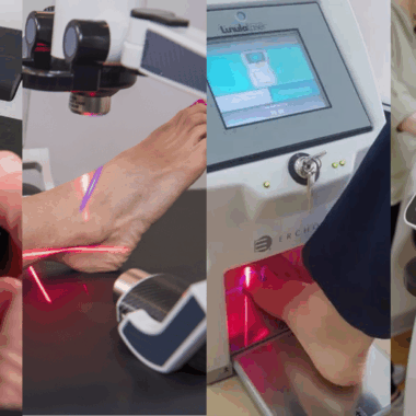 Choosing the Ideal Laser Therapy Device for Your Practice